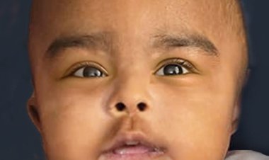 ഐസക് ബർളിനു (8മാസം) പ്രത്യാശയോടെ വിട