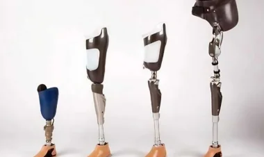 ഉദ്യോഗാർഥികളെ ആവശ്യമുണ്ട്;  Prosthetist & Orthotist ; P & O Technicians