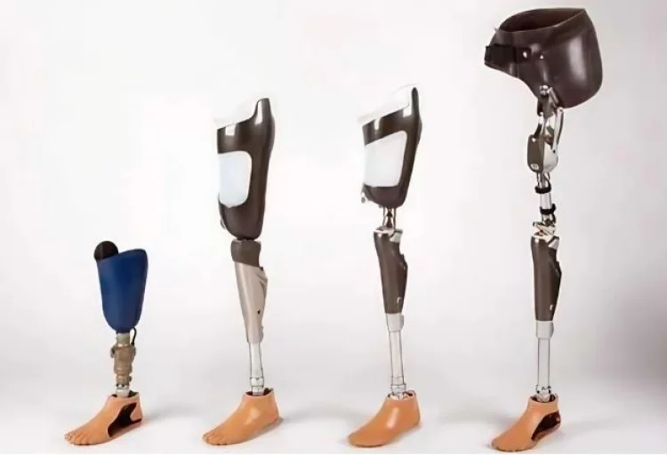 ഉദ്യോഗാർഥികളെ ആവശ്യമുണ്ട്;  Prosthetist & Orthotist ; P & O Technicians